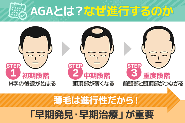 AGAの進行ステージの流れ