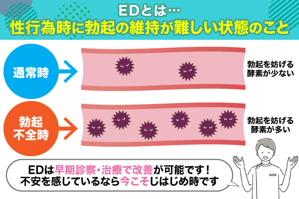 EDの仕組みについての図解