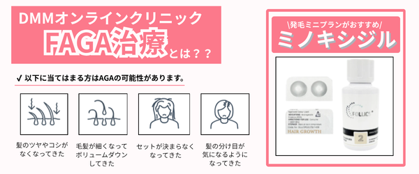 FAGA治療とミノキシジルの説明画像