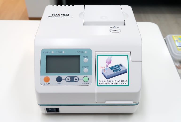 デンシトメトリー分析装置