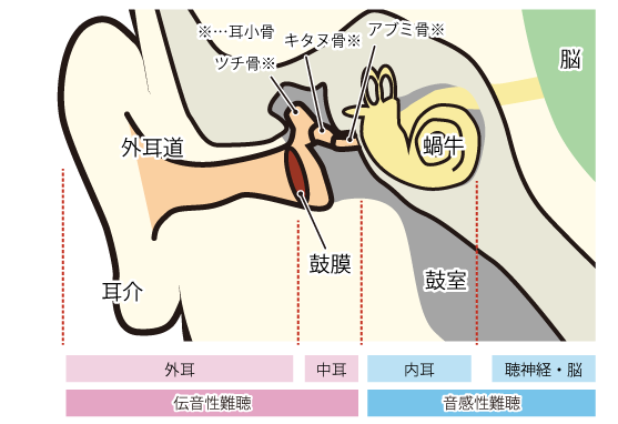 性 難聴 突発