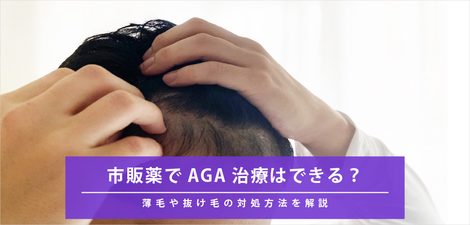 市販薬でAGA治療はできる？薄毛や抜け毛の対処方法を解説