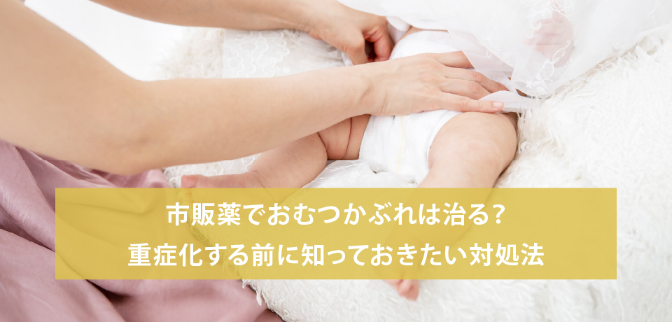 市販薬でおむつかぶれは治る？重症化する前に知っておきたい対処法